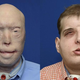 Image for article titled Behold the Most Extensive Face Transplant in Medical History